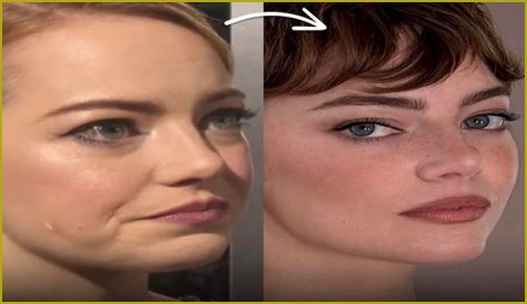Emma Stone Face Lift: Unveiling the Truth Behind Her Stunning Transformation