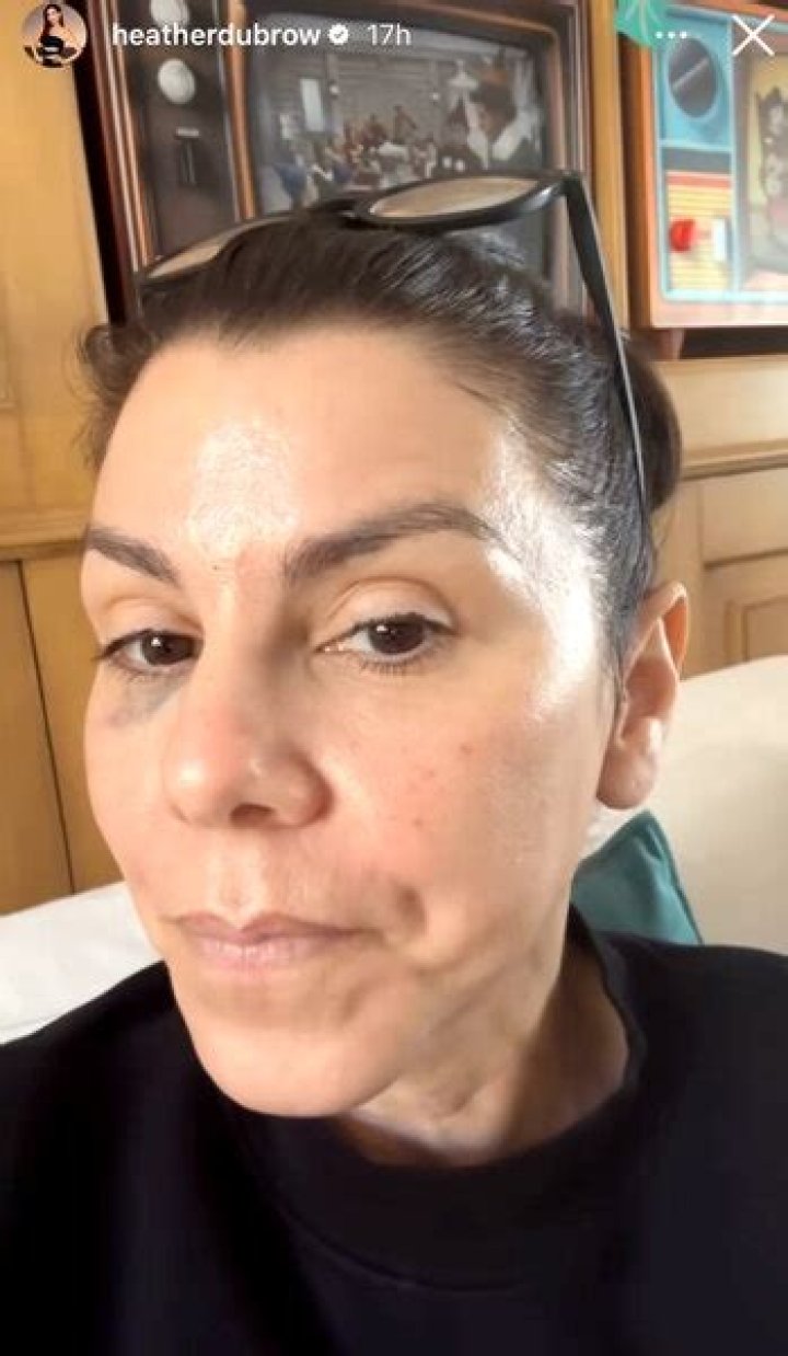 Heather Dubrow Shows 'Appreciation' for Terry Dubrow After MiniStroke
