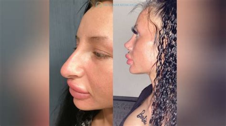 The Truth Behind Zoe Saldana's Nose: Plastic Surgery Or Natural?