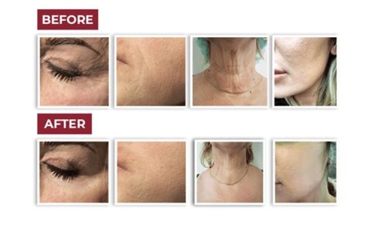 Ultimate Skin Rejuvenation: Rediscover Youthful Radiance