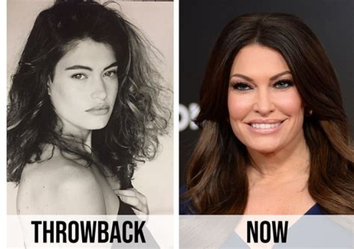 Unlocking The Secrets Of Kim Guilfoyle's Plastic Surgery Enhancements